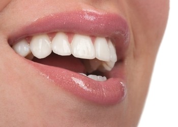 Close up of smile with flawless straight white teeth