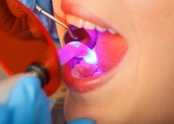 Close up of dental patient receiving dental bonding on tooth