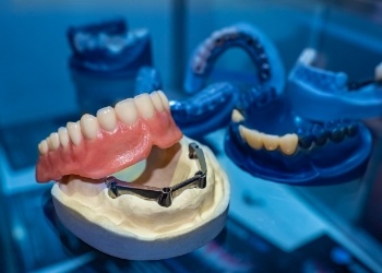 Model of an implant denture in a dental office