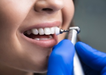 Close up of dental patient having their teeth professionally cleaned