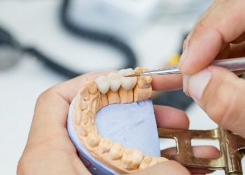 Ceramist designing a dental bridge