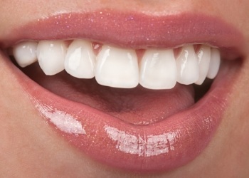 Close up of smile with flawless straight white teeth